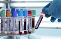 DỊCH VỤ XÉT NGHIỆM DỊ ỨNG VÀ TEST KHÁNG SINH