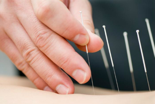 tập vật lý trị liệu