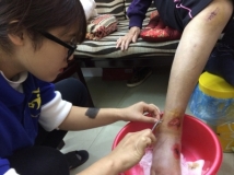 DỊCH VỤ THAY BĂNG, CÁT CHỈ, RỬA VẾT THƯƠNG TẠI NHÀ